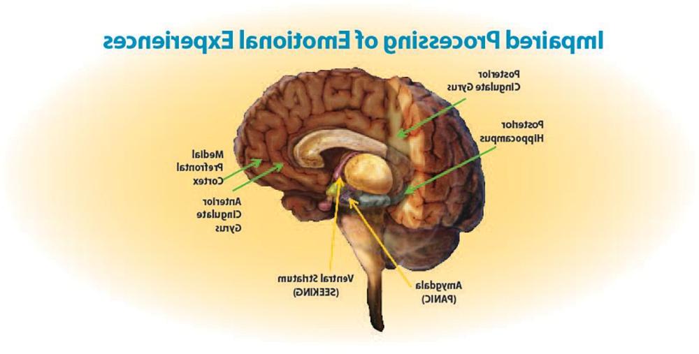 Higher-level regions of the brain (green arrows) either atrophy or underreact to emotional situations; lower regions (yellow arrows) become hyperreactive -- leading to a high arousal and impulsive pleasure-seeking.